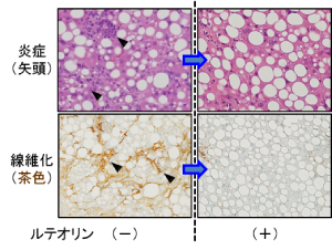 図１．ラット肝組織像：「ルテオリン」の摂取は肝の炎症（上）と線維化（下）を抑制した